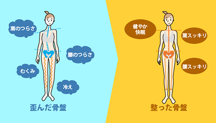 事務職の肩こりを治したい!おすすめ整体「カラダファクトリー」でラクになった話